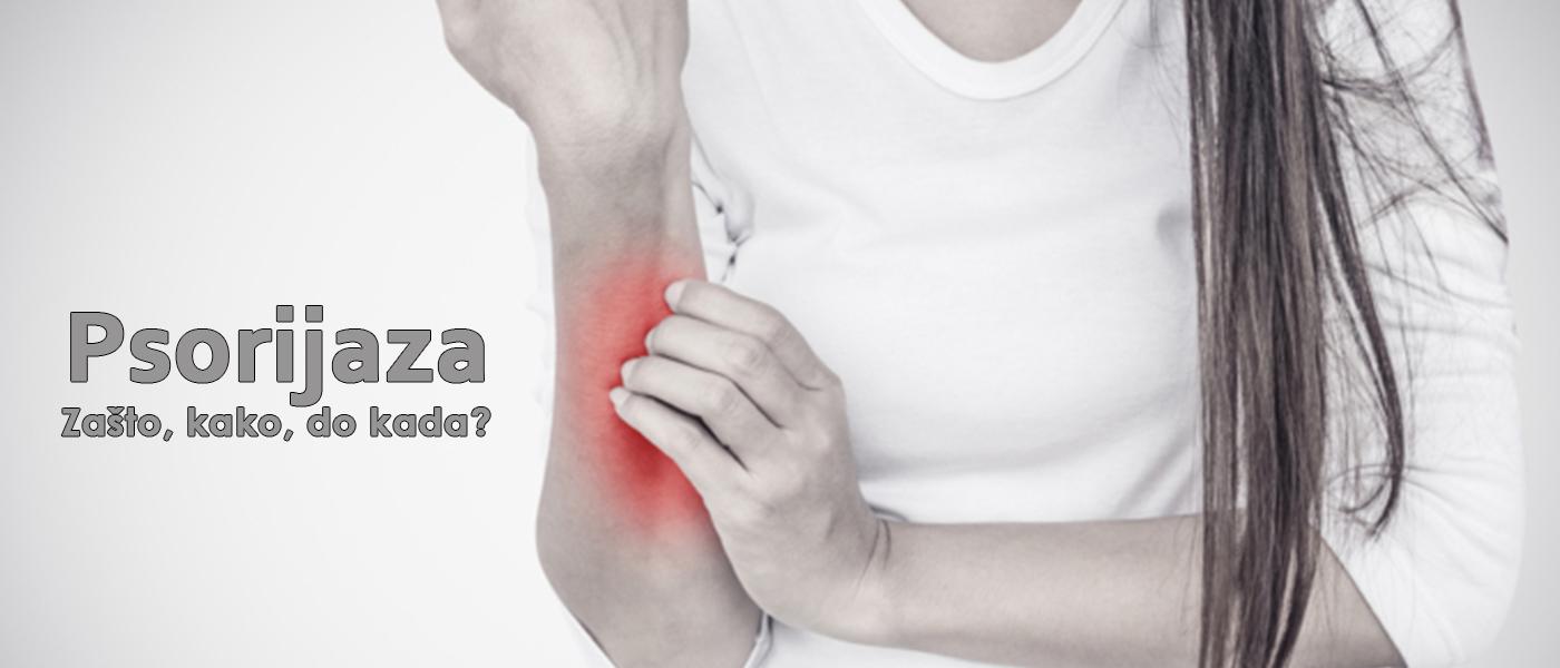 Psorijaza  –  zašto, kako, do kada !?